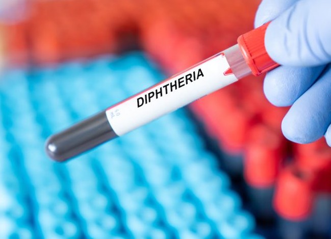 Camp des réfugiés de Mberra: une épidémie de diphtérie maitrisée